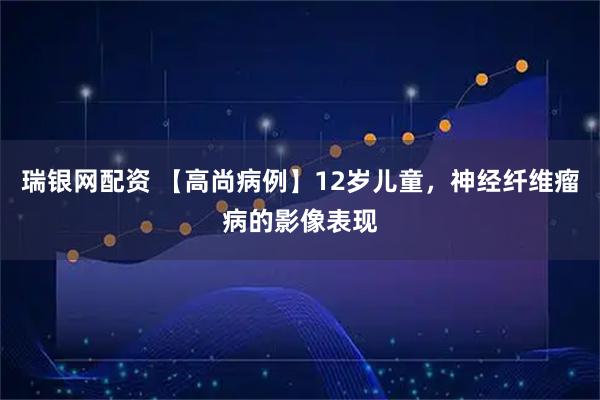 瑞银网配资 【高尚病例】12岁儿童，神经纤维瘤病的影像表现